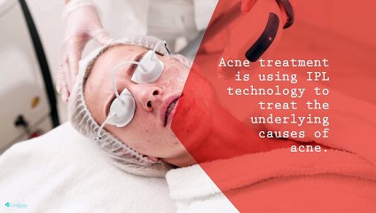 What are the Different Types of Versa Treatment