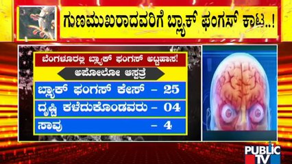Bengaluru Reports Over 200 Black Fungus Cases..! What Are The Symptoms Of Black Fungus Infection..?