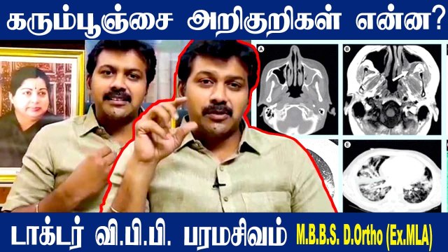 Black Fungus எப்படி ஏற்படுகிறது? | எவ்வாறு தடுப்பது? | Treatments & Medicines | Dr VPB Paramasivam