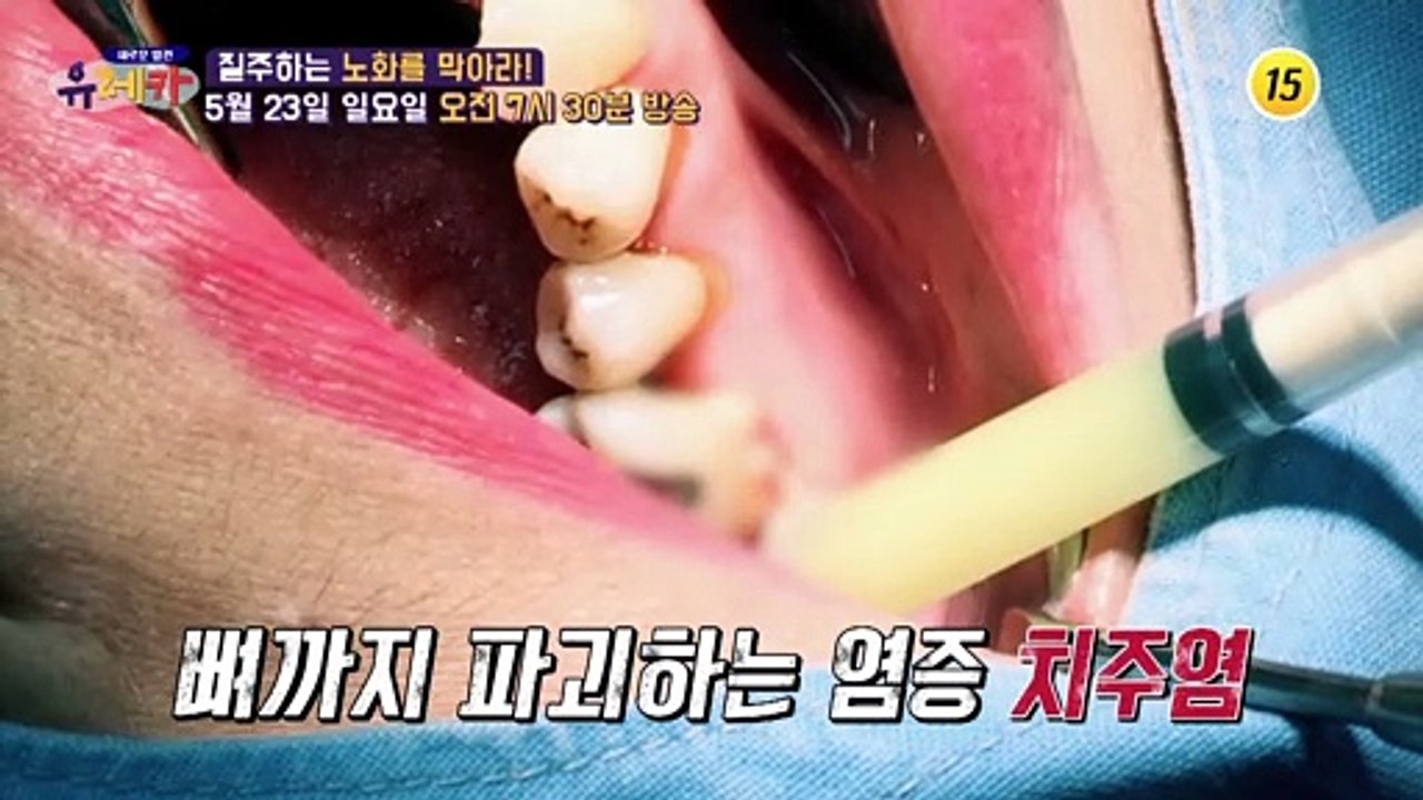 질주하는 노화를 막아라! 내 몸의 안전밸트 콜라겐_새로운 발견 유레카 16회 예고 T...