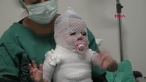 ESKİŞEHİR Kaynar suyla haşlanan Beril bebek Yanık Merkezi'nde tedavi altında