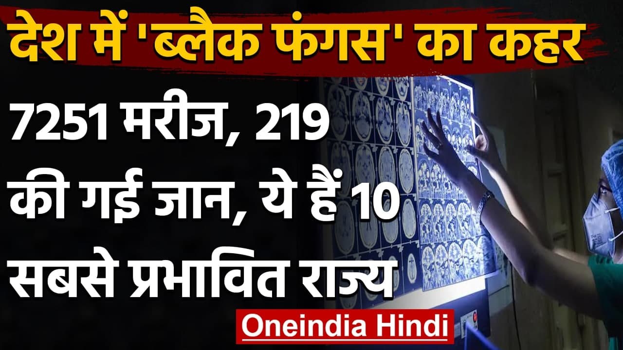 Black Fungus India: तेजी से फैल रहा ब्लैक फंगस, 7251 मामले, 219 मरीजों की मौत | वनइंडिया हिंदी