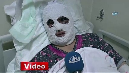 Temizlik yaparken bu hale geldi