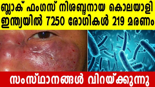 Black fungus: 7,250 infected, 219 dead in India | Oneindia Malayalam