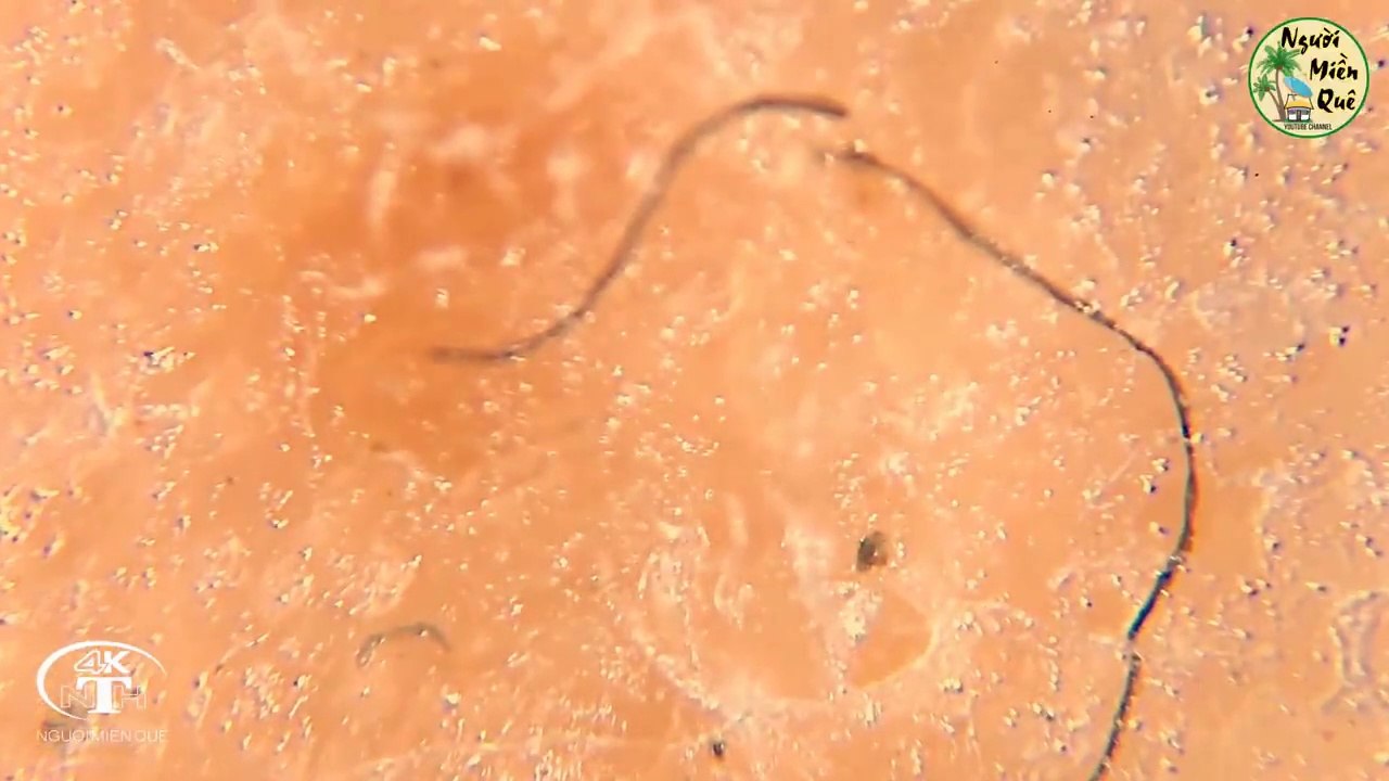 Sausage under microscope Xúc xích soi dưới kính hiển vi Xem xong hết