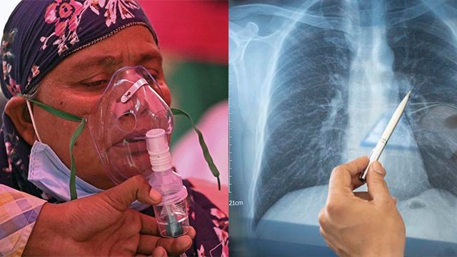 Corona Virus Treatment में इस 1 गलती से बढ़ रहा Black Fungus, ऐसे रहें ALERT | Boldsky