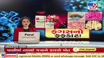 Doctor explains what is Mucormycosis, how it occurs and how to prevent it, Ahmedabad _ TV9News