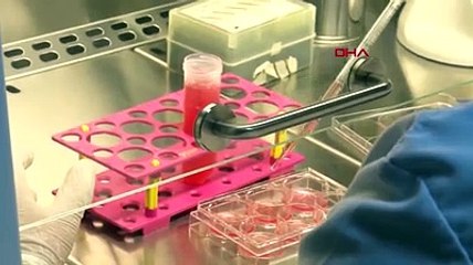 Her gün şekerli içecek tüketen kadınlarda bağırsak kanseri riski yüzde 32 artıyor