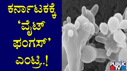 White Fungus Infection Found In Raichur District | White Fungus | Raichur
