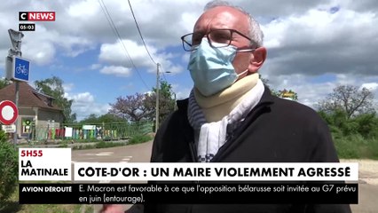 Côte-d’Or : Le maire de la petite ville d’Ouges roués à coups de barre de fer par un groupe d’hommes après une remarque de l’élu sur la vitesse excessive d’un quad