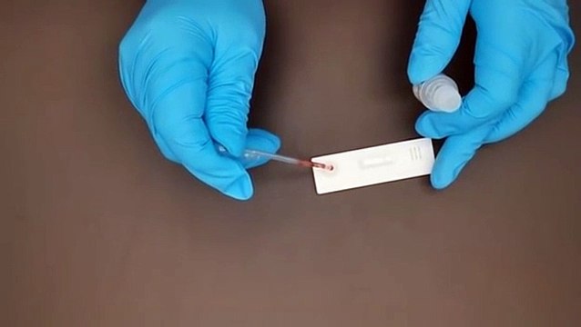 Covid-19 Igm/Igg Rapid Test Kit