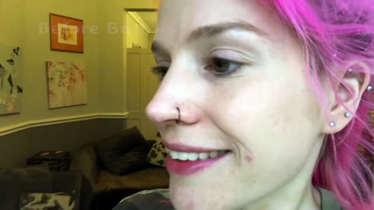 What I Wished I Knew Before Having Botox & Why I'Ll Never Get It Again