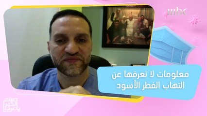 أهم مسببات الإصابة بالتهاب الفطر الأسود وهذه هي الجرعات المحددة من لقاح كورونا