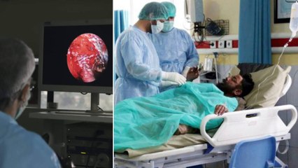 Yellow Fungus Cases Reported In UP | Oneindia Telugu