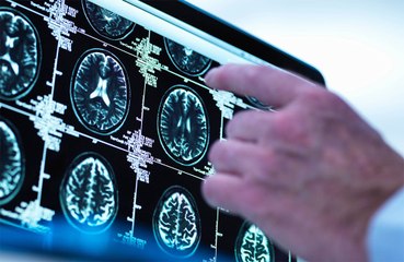 Watching too much TV in middle age can harm the brain