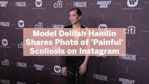 Model Delilah Hamlin Shares Photo of 'Painful' Scoliosis on Instagram