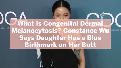What Is Congenital Dermal Melanocytosis? Constance Wu Says Daughter Has a Blue Birthmark o