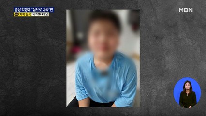 방과 후 수업 중 무차별 폭행…두개골 금 갔는데 '귀가 조치만'