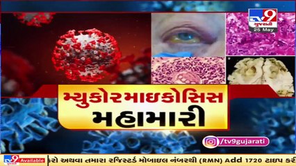 Mucormycosis cases on rise in Surat, 50 patients lost eye vision _ Tv9GujaratiNews