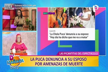 Picantitas del Espectáculo: Todo sobre la nueva cirugía que  se habría realizado Flavia Laos