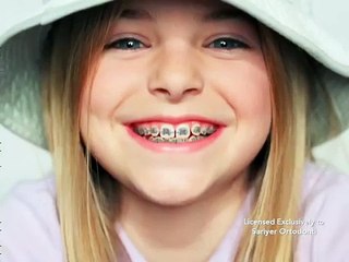 Diş teli nasıl takılır?