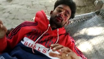 सड़क पर गड्ढे दे रहे हैं हादसों को दावत