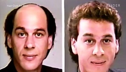 A dermatologist explains why some men lose their hair