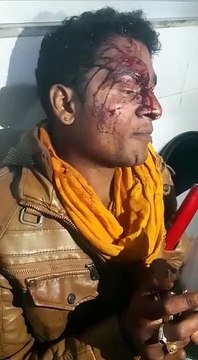 मंदसौरः भीलवाड़ा बस दुर्घटना में घायलों को मिलेगी सरकार से आर्थिक सहायता