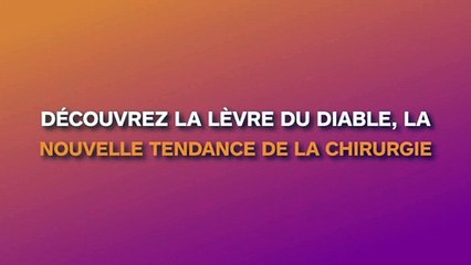 Découvrez "la lèvre du diable", la nouvelle tendance de la chirurgie
