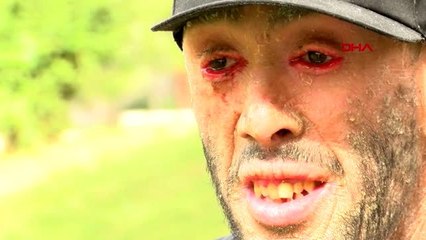 Cilt hastası refik töre, tedavi umuduyla istanbul'a geldi