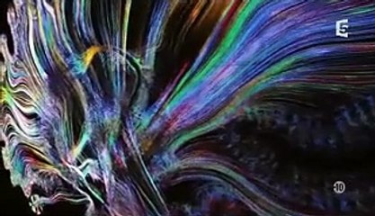 Amnésie Traumatique et IRM cérébrale