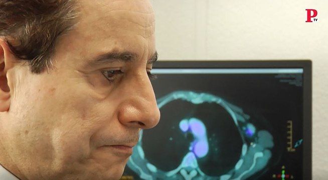 Cáncer de mama: Hay fármacos que lo previenen y no se usan