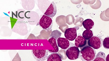 Un la­bo­ra­to­rio bus­ca re­du­cir las muer­tes por leu­ce­mia en ni­ños me­xi­ca­nos