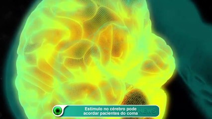 Estímulo no cérebro pode acordar pacientes do coma