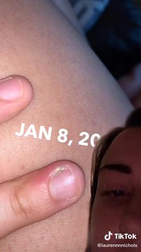 Elle se ronge les ongles et est à deux doigts de se faire amputer