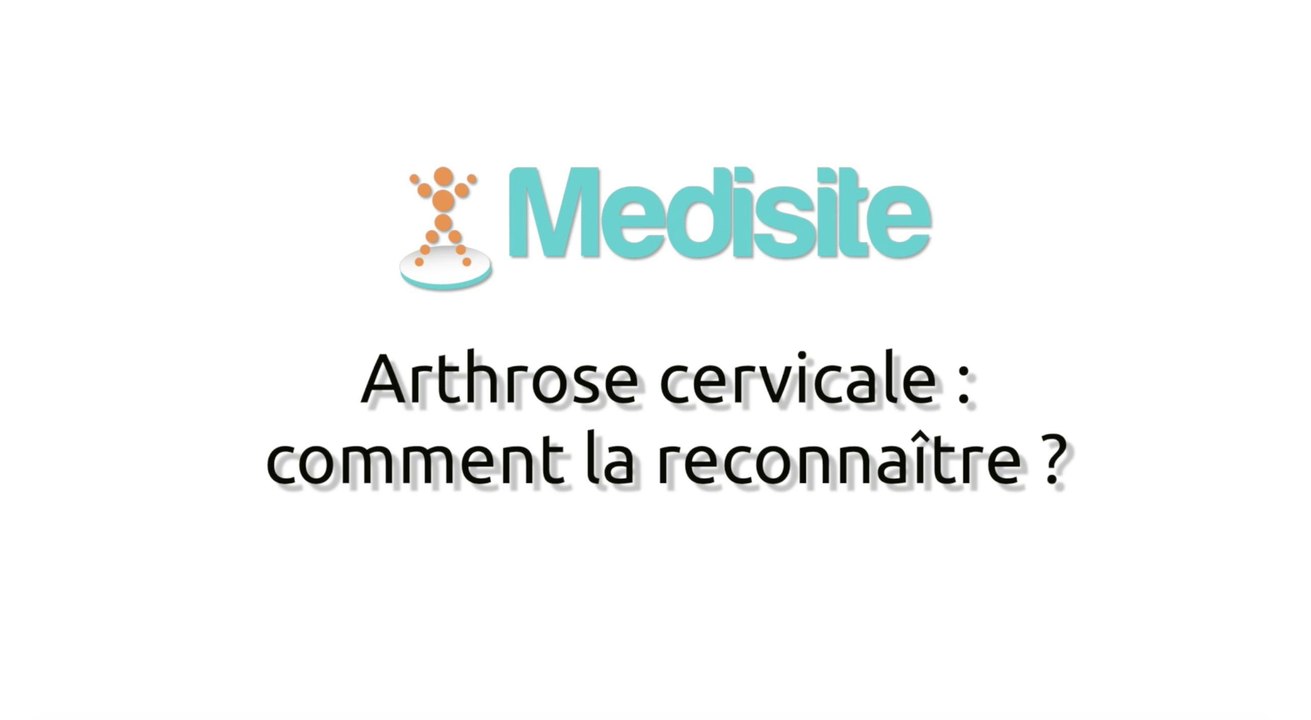 Arthrose cervicale : comment la reconnaître ?