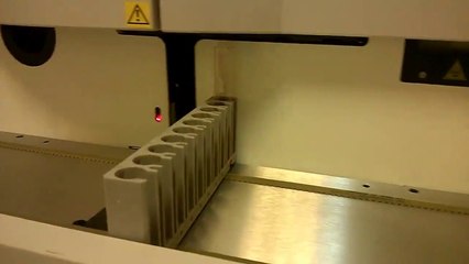 İdrarda kan gelmesi nedenleri nedir NASIL GÖRÜNÜR ?