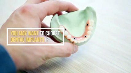 Dental Implants | claritydentist.com | Call  (714) 534-2628