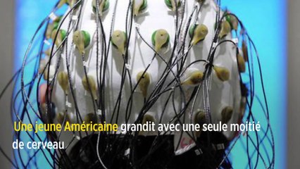 Une jeune Américaine grandit avec une seule moitié de cerveau