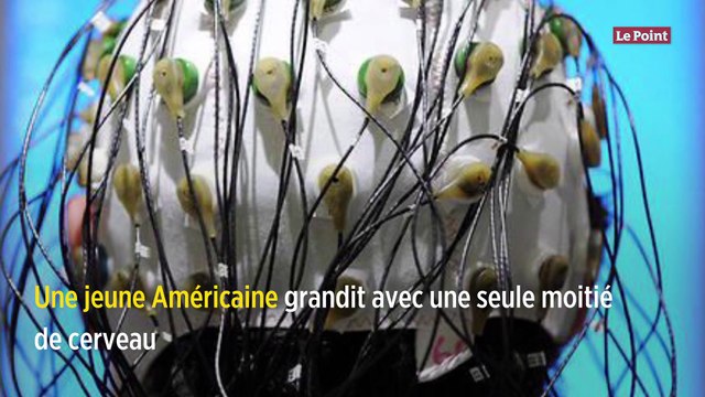 Une jeune Américaine grandit avec une seule moitié de cerveau