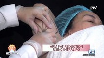 DERMAESTHETIQUE: Arm fat reduction using intralipo