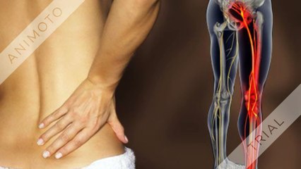 AGIL Flex - An Help Reduce Inflammation Naturally