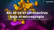 Así se ve bajo el microscopio el coronavirus que tiene en alerta al mundo