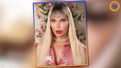 Une star de télé-réalité s'affiche le visage très gonflé sur les réseaux sociaux