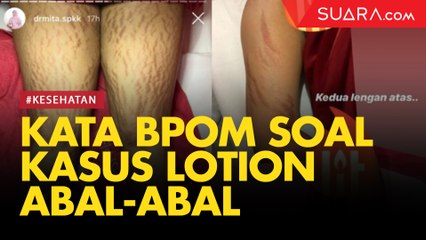 Heboh Kulit Rusak karena Lotion Abal-abal, BPOM: Masyarakat Harus Cerdas