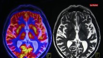 Après la mort, des cellules du cerveau restent fonctionnelles pendant 48 heures