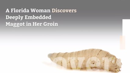 A Florida Woman Discovers Deeply Embedded Maggot in Her Groin