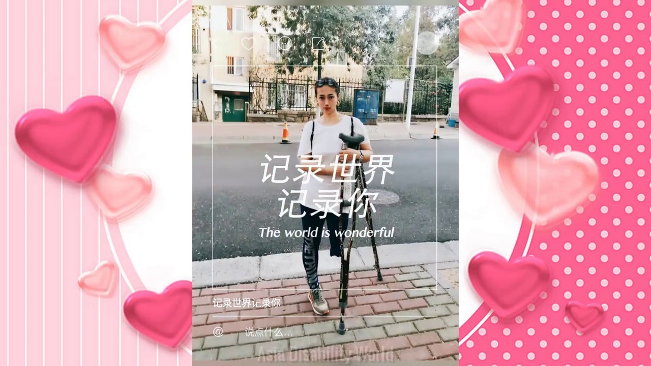 Asia Amputee Girl #1 :  Cool Amputee | Fashion one leg girl style | Asia Amputee Model