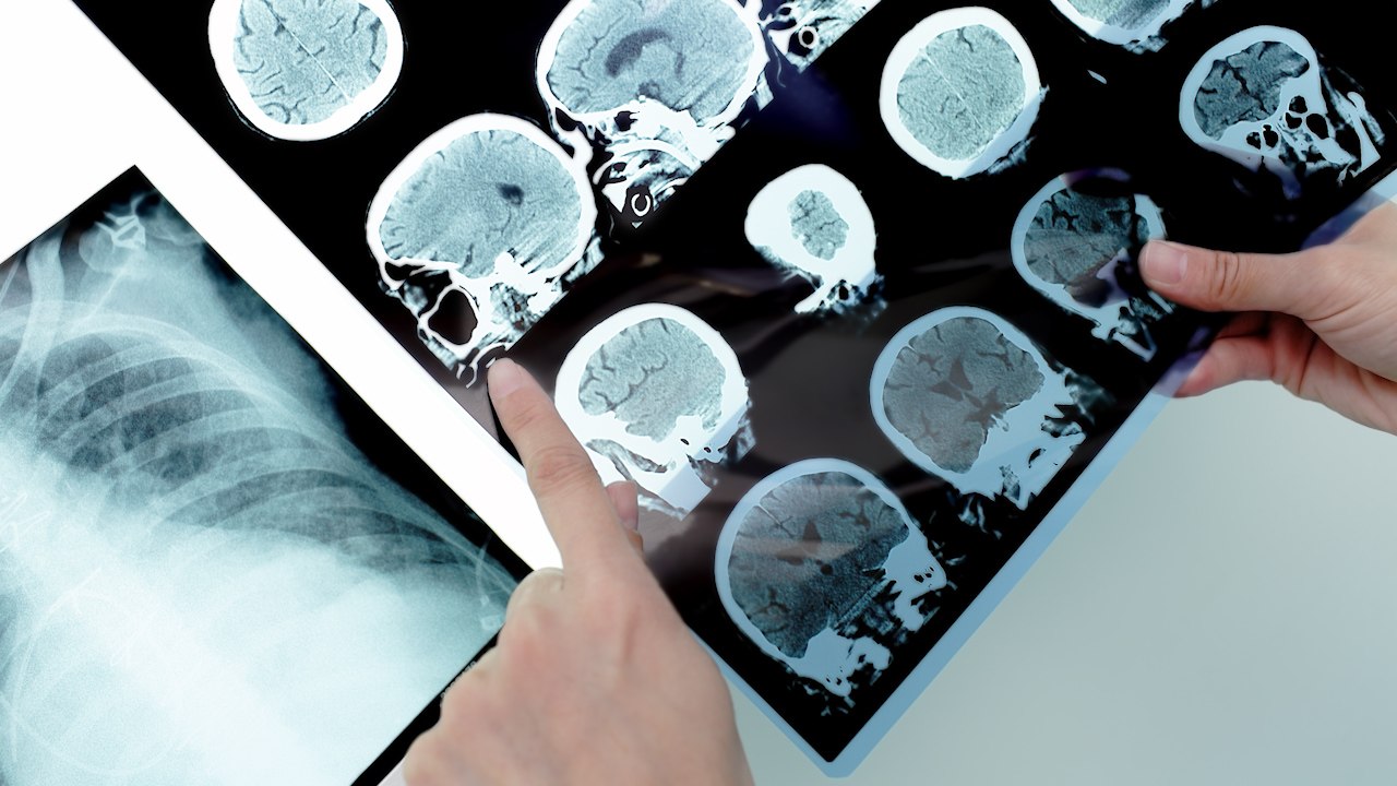 MRI Machines Are Leaving The Hospital And Going Portable