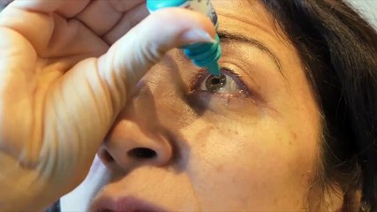 Dry Eyes Doctor Los Angeles - Call (310) 820-2020 - Eyesite Optometric Group